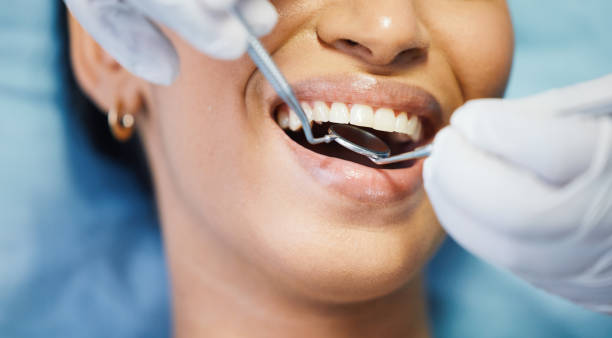 Best Mobile Emergency Dentist in Bay Minette, AL