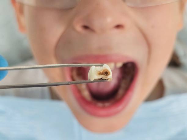 Best Mobile Emergency Dentist in Bay Minette, AL